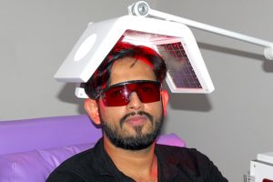 LOW LEVEL LASER THERAPY FOR HAIR 300x200