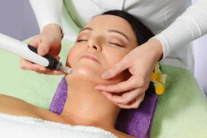 MICRONEEDLING Featured 300x200