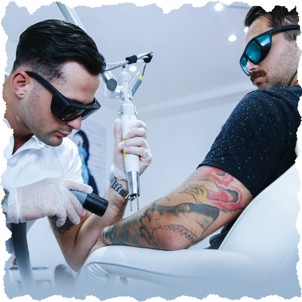 Laser tatoo removal process