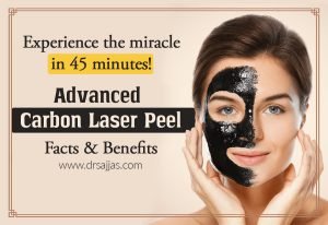 carbon laser peel in Tirupati
