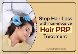 Hair PRP treatment