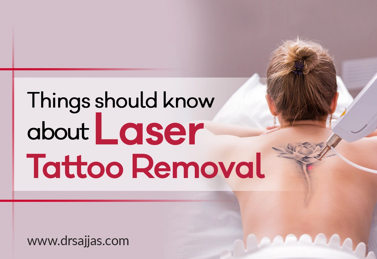 How Does Laser Tattoo Removal Works? - Dr Sajjas Clinic in Tirupati