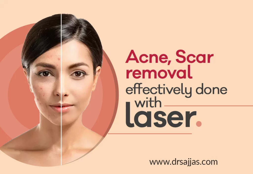 Laser scar removal