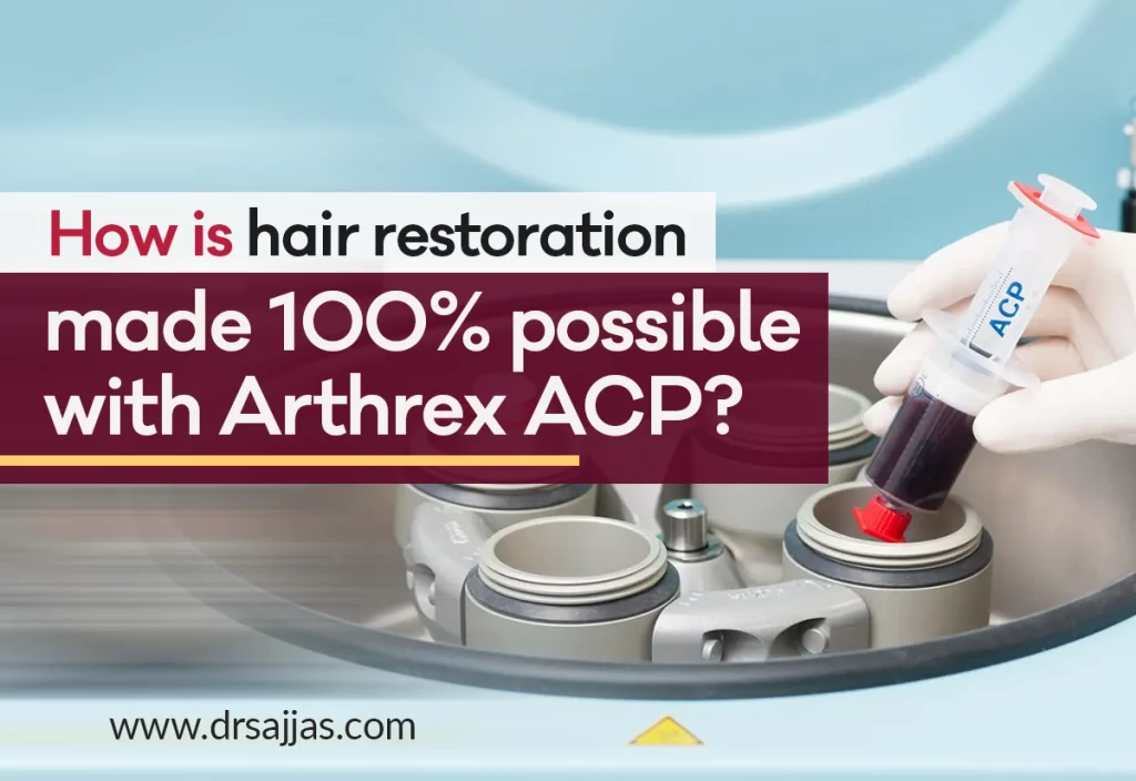Arthrex ACP
