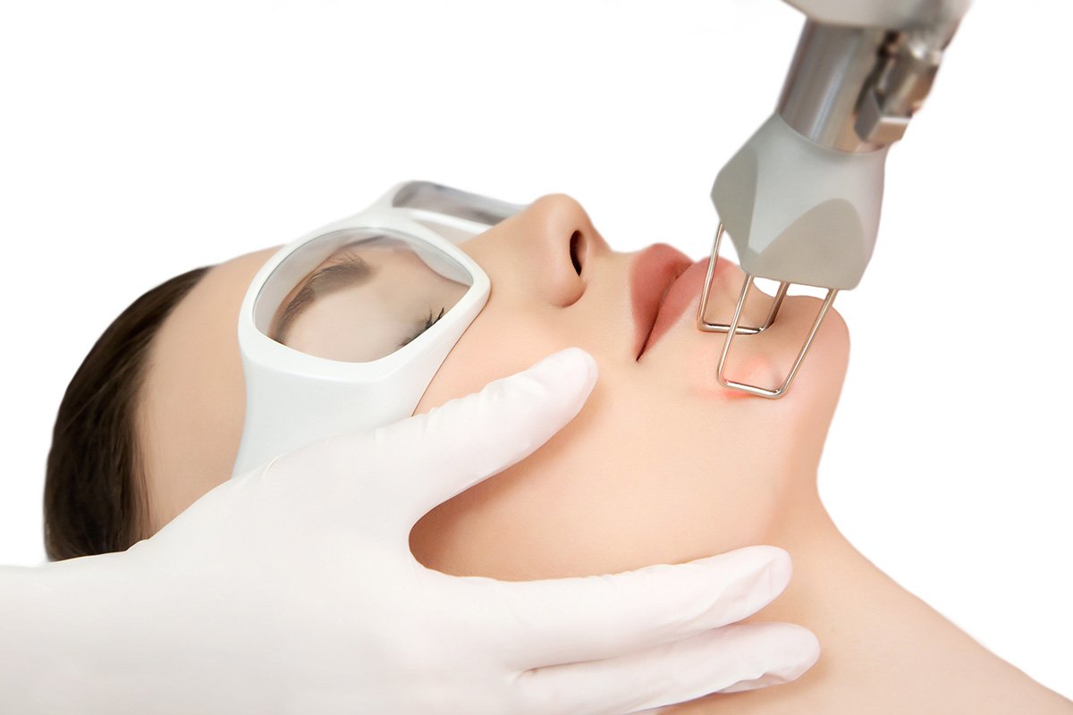 fractional co2 laser treatment