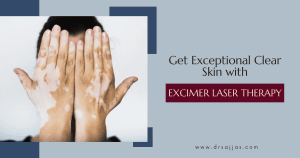 Excimer laser therapy