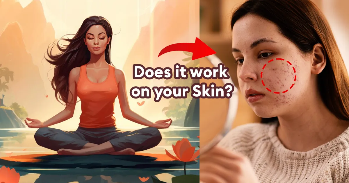 Yoga works for your Skin