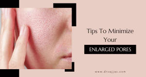 Enlarged Pores 300x158