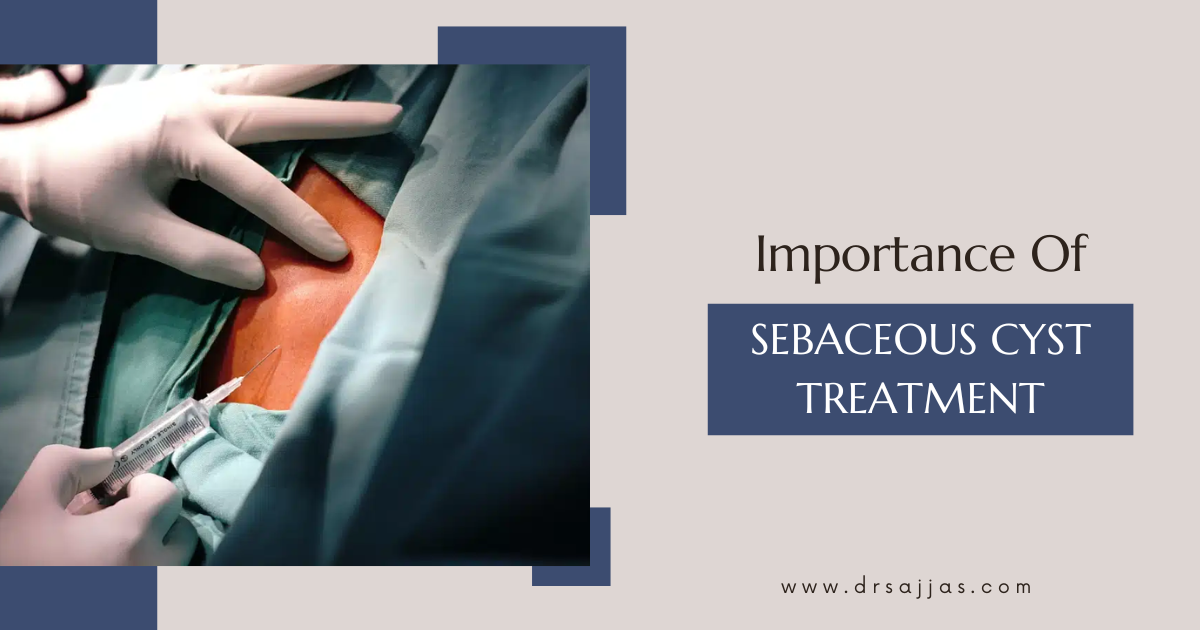 Sebaceous Cyst Treatment