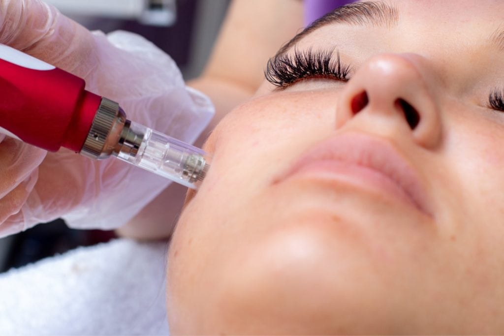 MNRF treatments